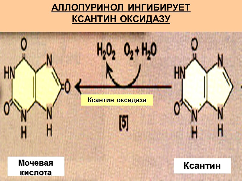 АЛЛОПУРИНОЛ ИНГИБИРУЕТ  КСАНТИН ОКСИДАЗУ  Ксантин оксидаза Ксантин Мочевая кислота